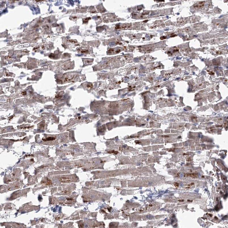 RIN2 Antibody - BSA Free Immunohistochemistry-Paraffin: RIN2 Antibody [NBP1-80854]