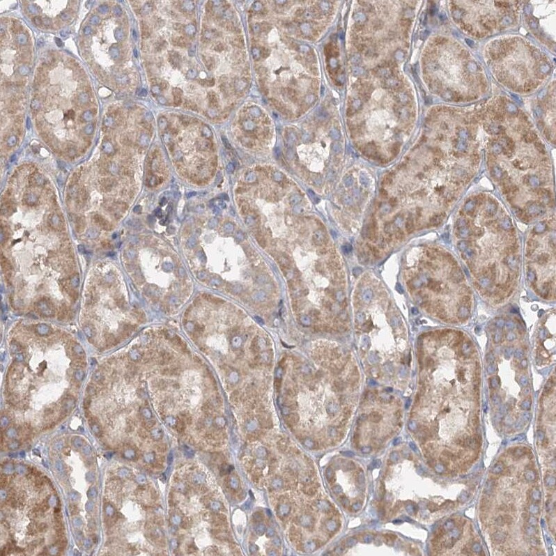 RIN2 Antibody - BSA Free Immunohistochemistry-Paraffin: RIN2 Antibody [NBP1-80854]