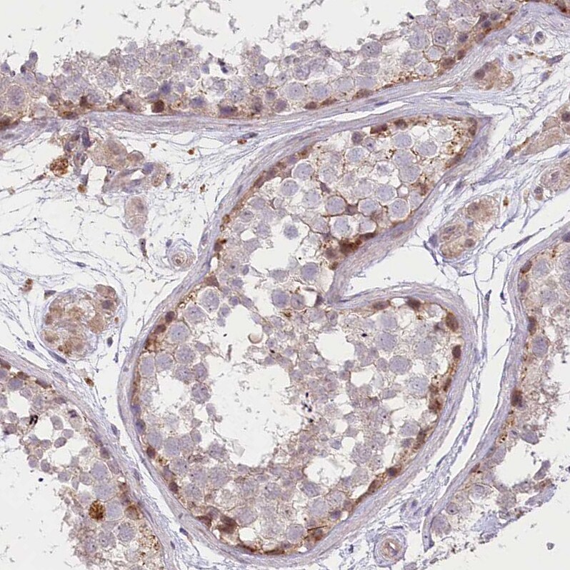TRUB1 Antibody - BSA Free Immunohistochemistry-Paraffin: TRUB1 Antibody [NBP1-80866]