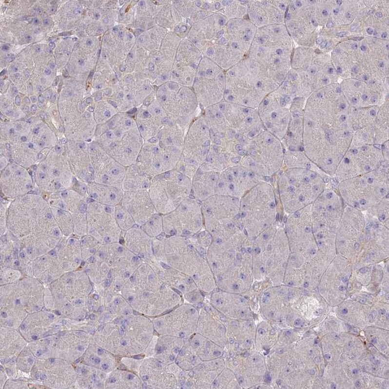 TRUB1 Antibody - BSA Free Immunohistochemistry-Paraffin: TRUB1 Antibody [NBP1-80866]