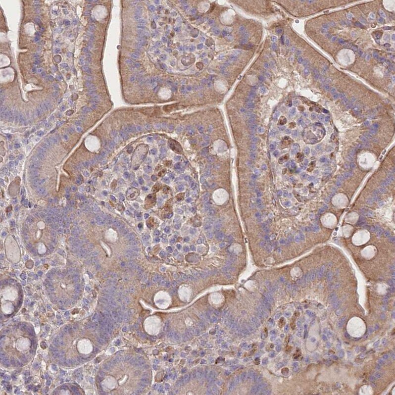 TRUB1 Antibody - BSA Free Immunohistochemistry-Paraffin: TRUB1 Antibody [NBP1-80866]
