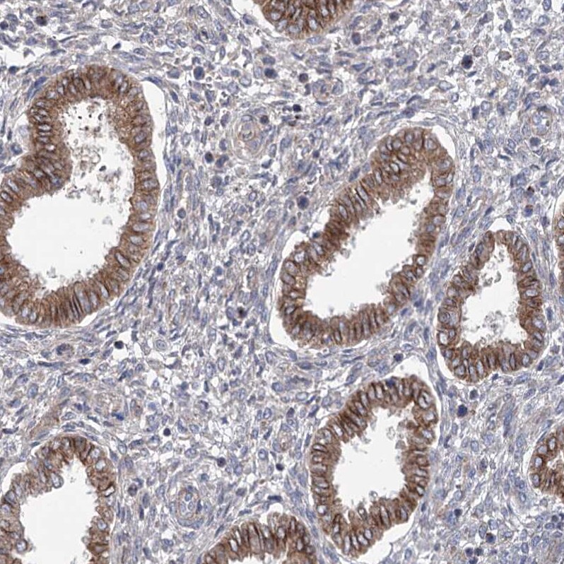 TRUB1 Antibody - BSA Free Immunohistochemistry-Paraffin: TRUB1 Antibody [NBP1-80866]