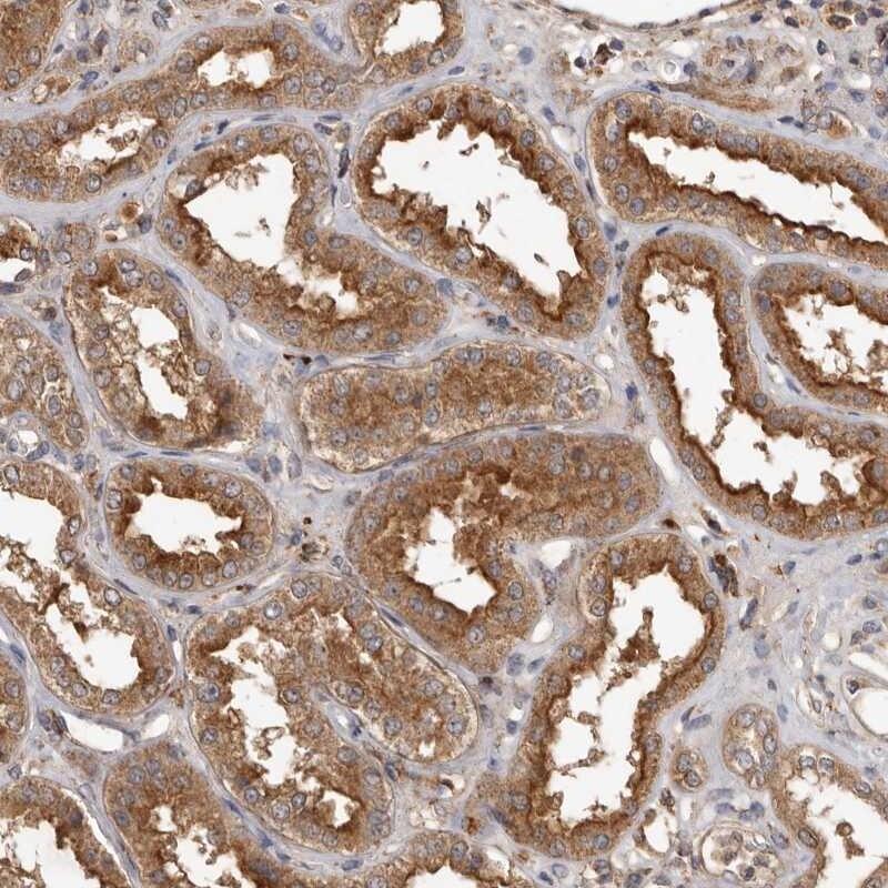 RWDD1 Antibody - BSA Free Immunohistochemistry: RWDD1 Antibody - BSA Free [NBP1-80870]