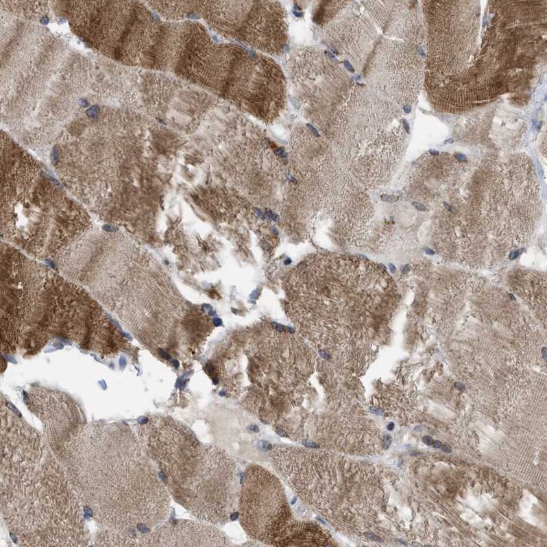 TMEM159 Antibody - BSA Free Immunohistochemistry-Paraffin: TMEM159 Antibody [NBP1-80877]