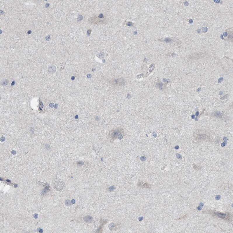 TMEM159 Antibody - BSA Free Immunohistochemistry-Paraffin: TMEM159 Antibody [NBP1-80877]