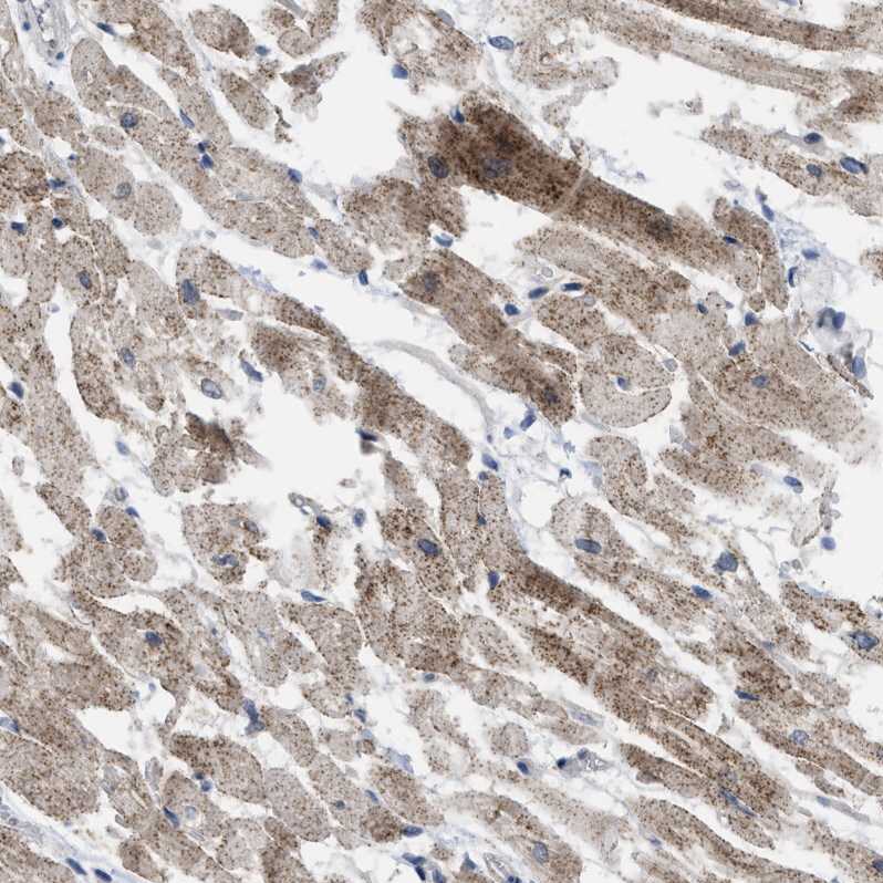 TMEM159 Antibody - BSA Free Immunohistochemistry-Paraffin: TMEM159 Antibody [NBP1-80877]
