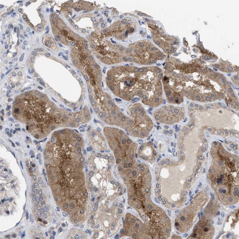 TMEM159 Antibody - BSA Free Immunohistochemistry-Paraffin: TMEM159 Antibody [NBP1-80877]