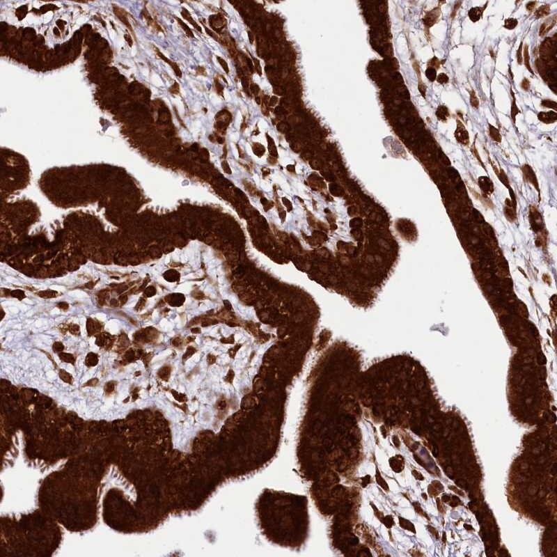 LARP4 Antibody - BSA Free Immunohistochemistry-Paraffin: LARP4 Antibody [NBP1-80889]