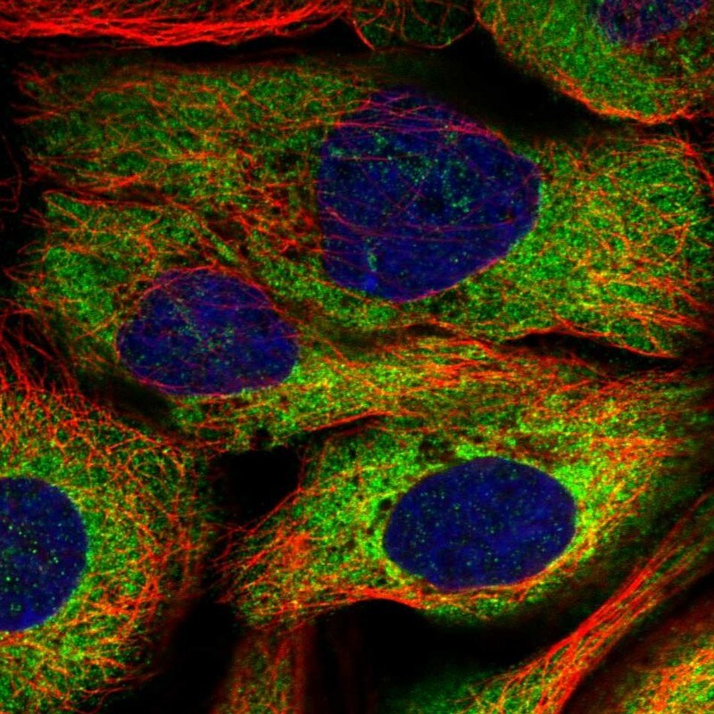 LARP4 Antibody - BSA Free Immunocytochemistry/ Immunofluorescence: LARP4 Antibody [NBP1-80890]