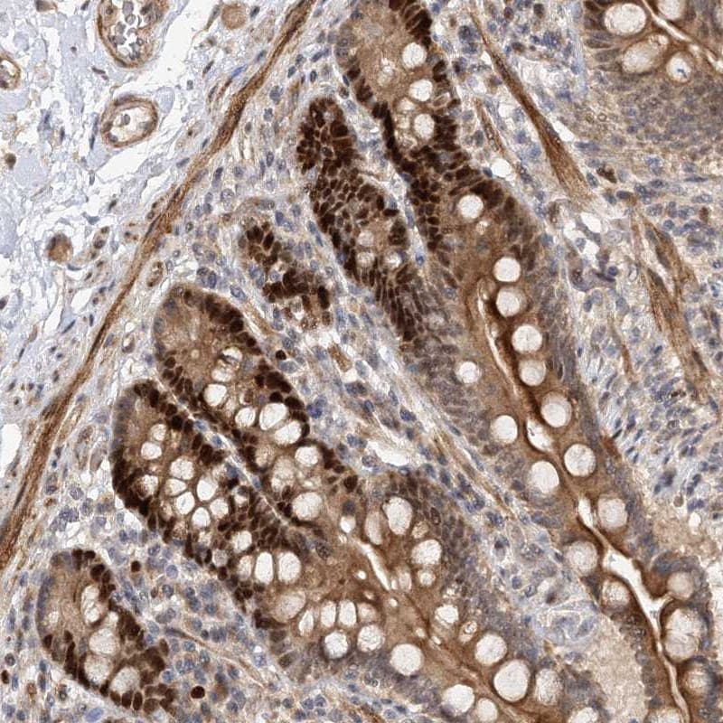 PIK3C2A Antibody - BSA Free Immunohistochemistry-Paraffin: PIK3C2A Antibody [NBP1-80909]