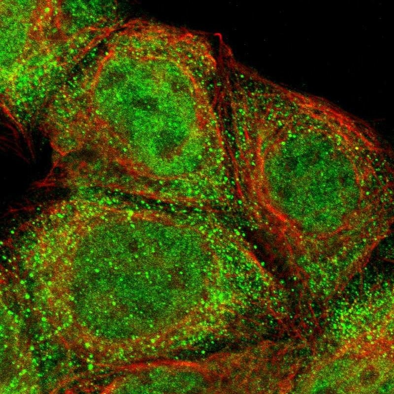 ZNF155 Antibody - BSA Free Immunocytochemistry/ Immunofluorescence: ZNF155 Antibody [NBP1-80912]
