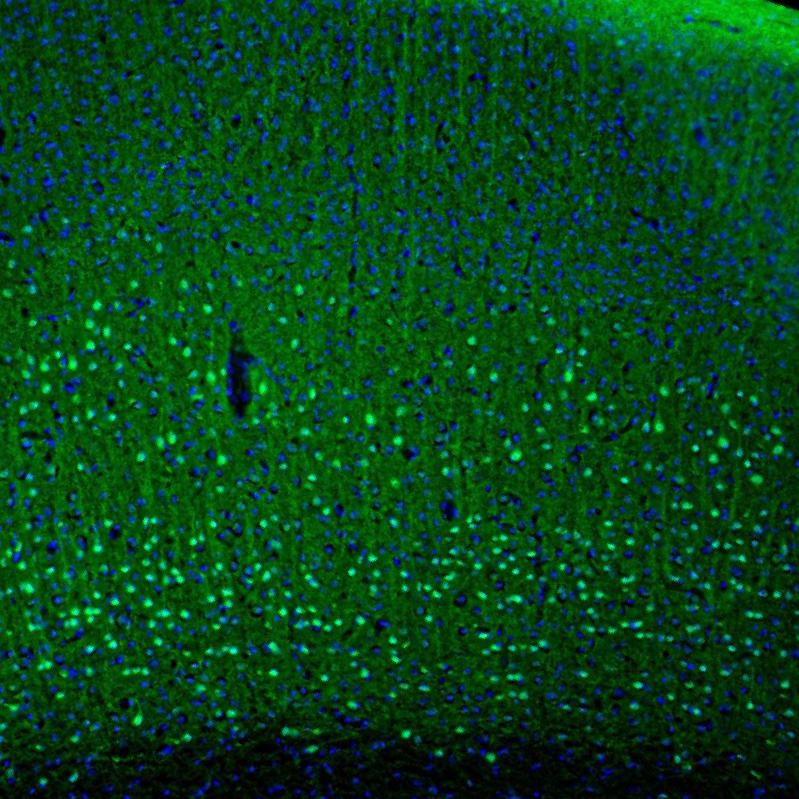 PCP4 Antibody - BSA Free Immunohistochemistry-Paraffin: PCP4 Antibody [NBP1-80929]