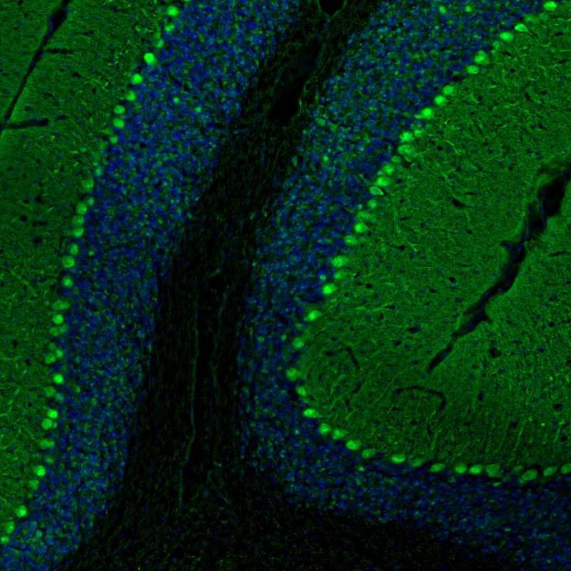 PCP4 Antibody - BSA Free Immunohistochemistry-Paraffin: PCP4 Antibody [NBP1-80929]