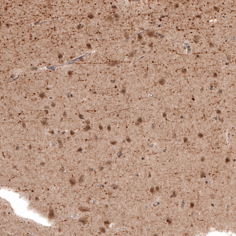 PCP4 Antibody - BSA Free Immunohistochemistry-Paraffin: PCP4 Antibody [NBP1-80929]