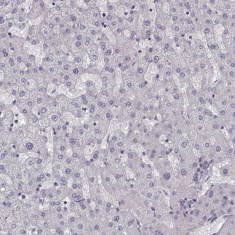 PCP4 Antibody - BSA Free Immunohistochemistry-Paraffin: PCP4 Antibody [NBP1-80929]