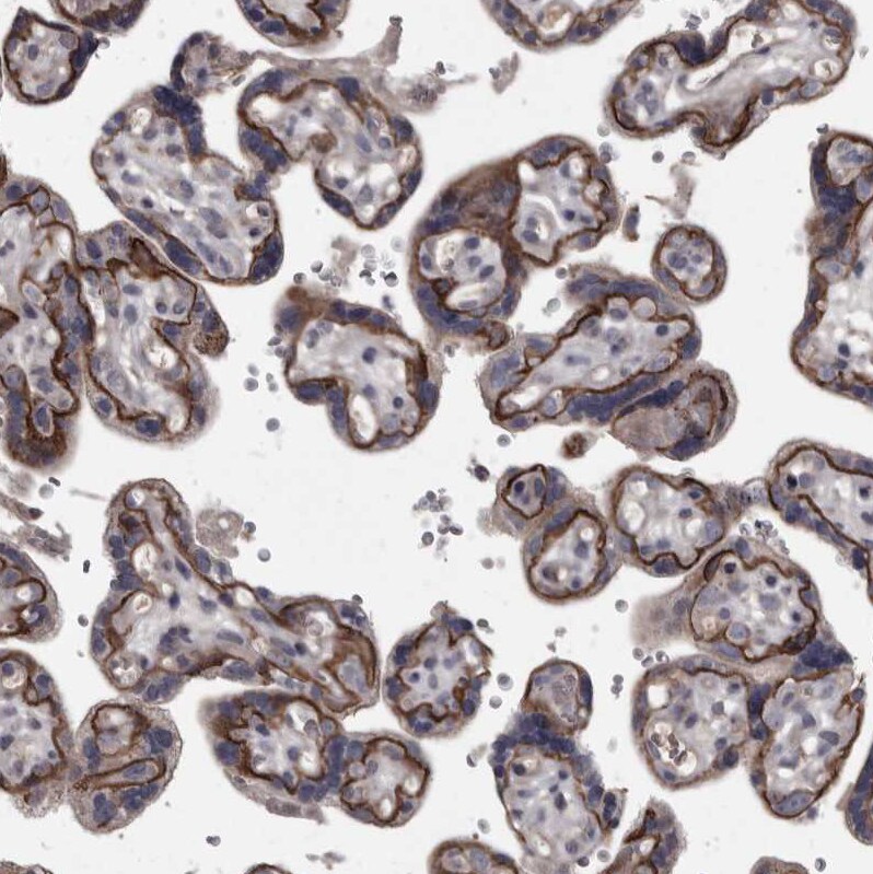 Protocadherin-17 Antibody - BSA Free Immunohistochemistry-Paraffin: Protocadherin-17 Antibody [NBP1-80943]