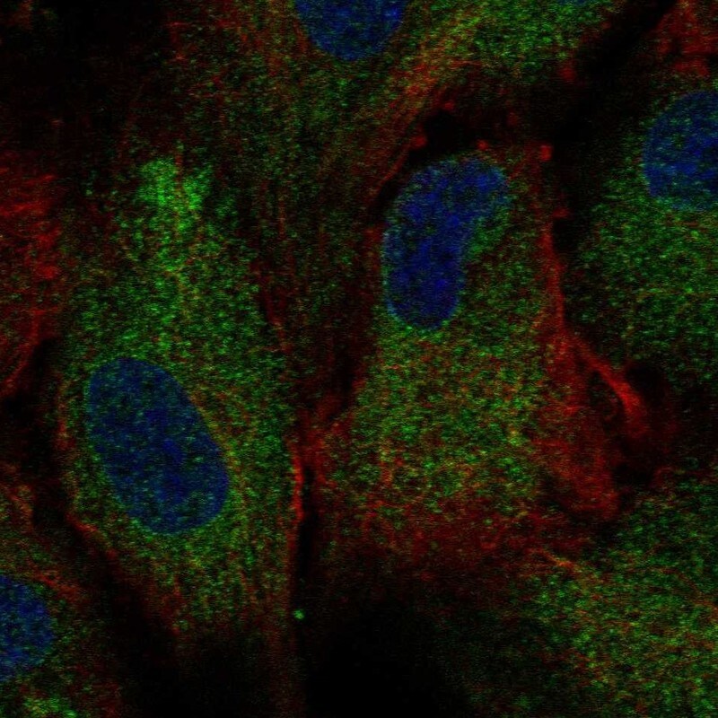 Polycystin 2 Antibody - BSA Free Immunocytochemistry/ Immunofluorescence: Polycystin 2 Antibody [NBP1-80944]