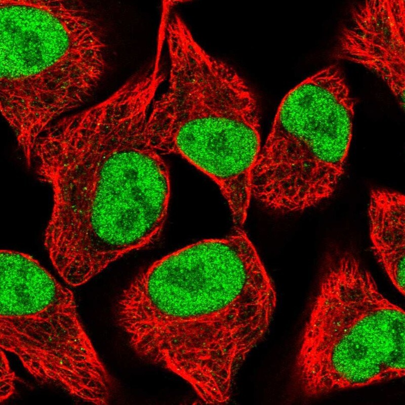SPANX-D Antibody Immunocytochemistry/ Immunofluorescence: SPANX-D Antibody [NBP2-14799]