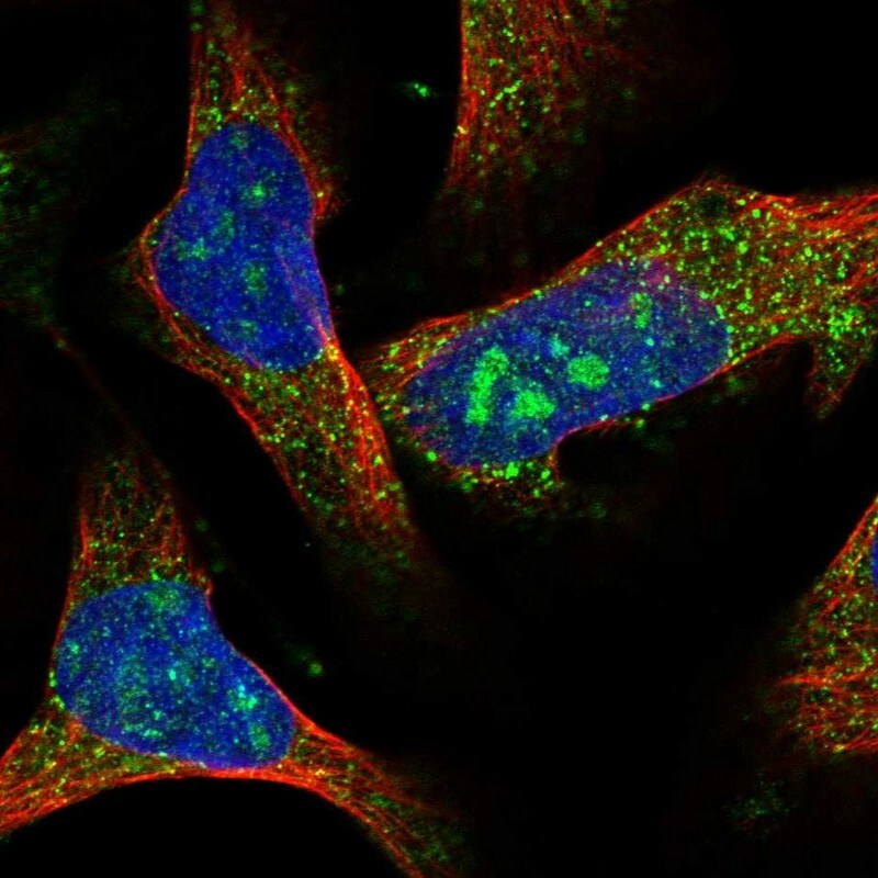 ACOX1 Antibody - BSA Free Immunocytochemistry/ Immunofluorescence: ACOX1 Antibody [NBP1-80950]