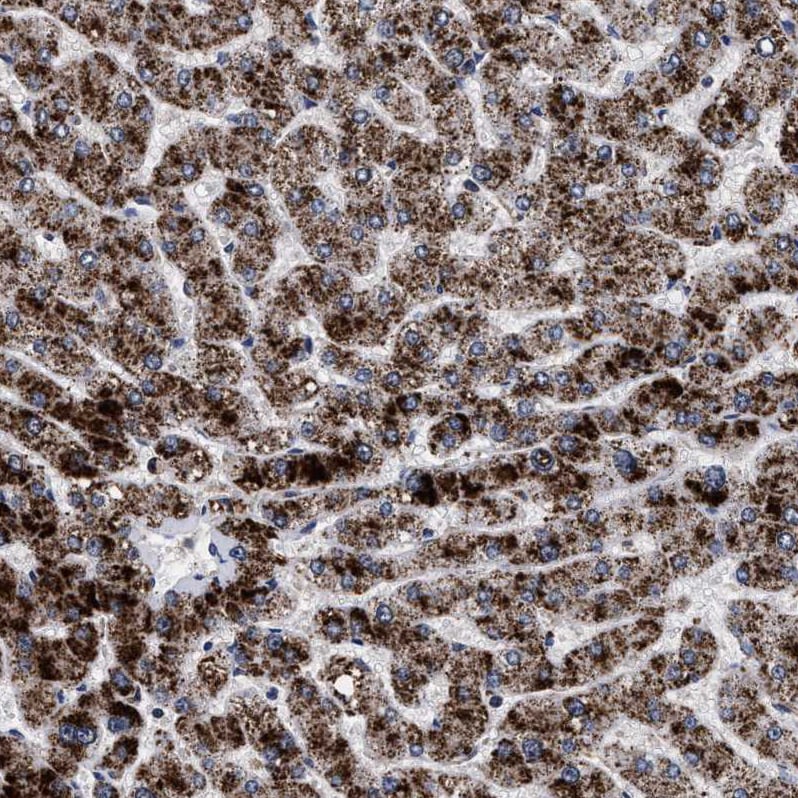 ACOX1 Antibody - BSA Free Immunohistochemistry-Paraffin: ACOX1 Antibody [NBP1-80951]
