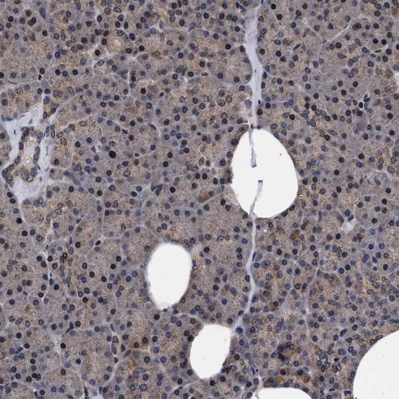 ACOX1 Antibody - BSA Free Immunohistochemistry-Paraffin: ACOX1 Antibody [NBP1-80951]