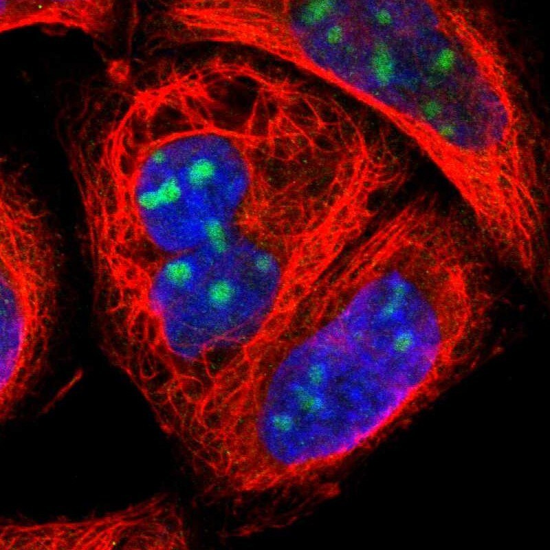 ZNF146 Antibody - BSA Free Immunocytochemistry/ Immunofluorescence: ZNF146 Antibody [NBP1-80968]