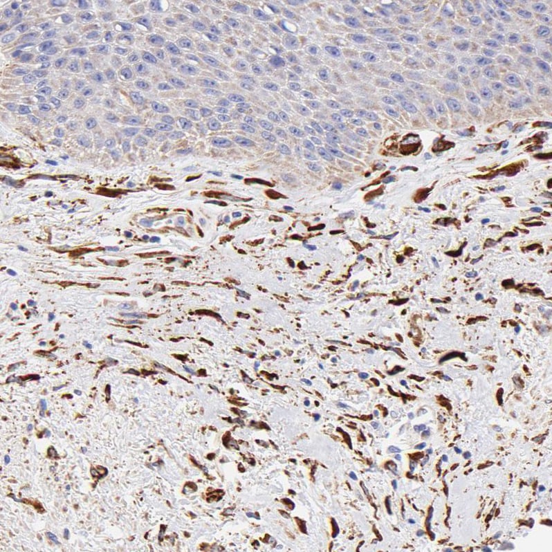 SPARC Antibody - BSA Free Immunohistochemistry-Paraffin: SPARC Antibody [NBP1-80971]