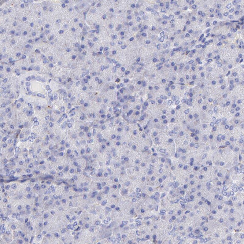 SPARC Antibody - BSA Free Immunohistochemistry-Paraffin: SPARC Antibody [NBP1-80971]