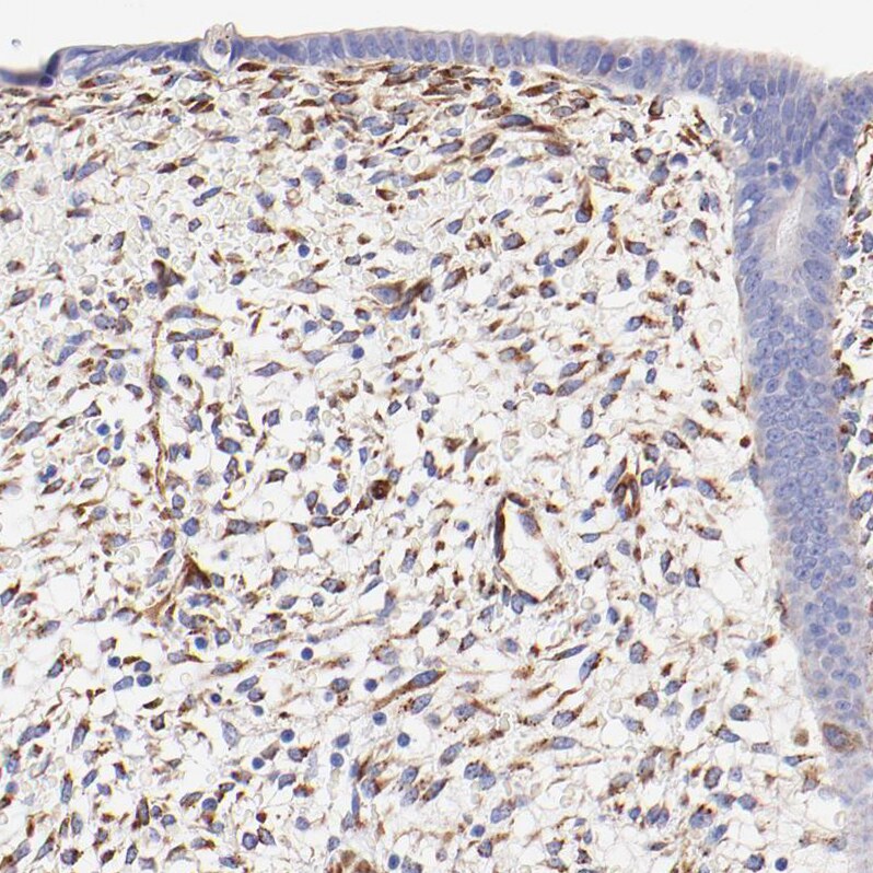 SPARC Antibody - BSA Free Immunohistochemistry-Paraffin: SPARC Antibody [NBP1-80971]