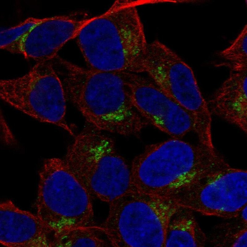 LRRC4 Antibody Immunocytochemistry/ Immunofluorescence: LRRC4 Antibody [NBP2-30399]