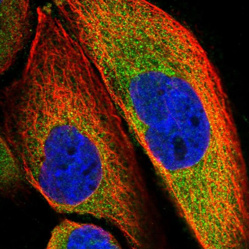 SLC9A5 Antibody - BSA Free Immunocytochemistry/ Immunofluorescence: SLC9A5 Antibody [NBP1-80996]