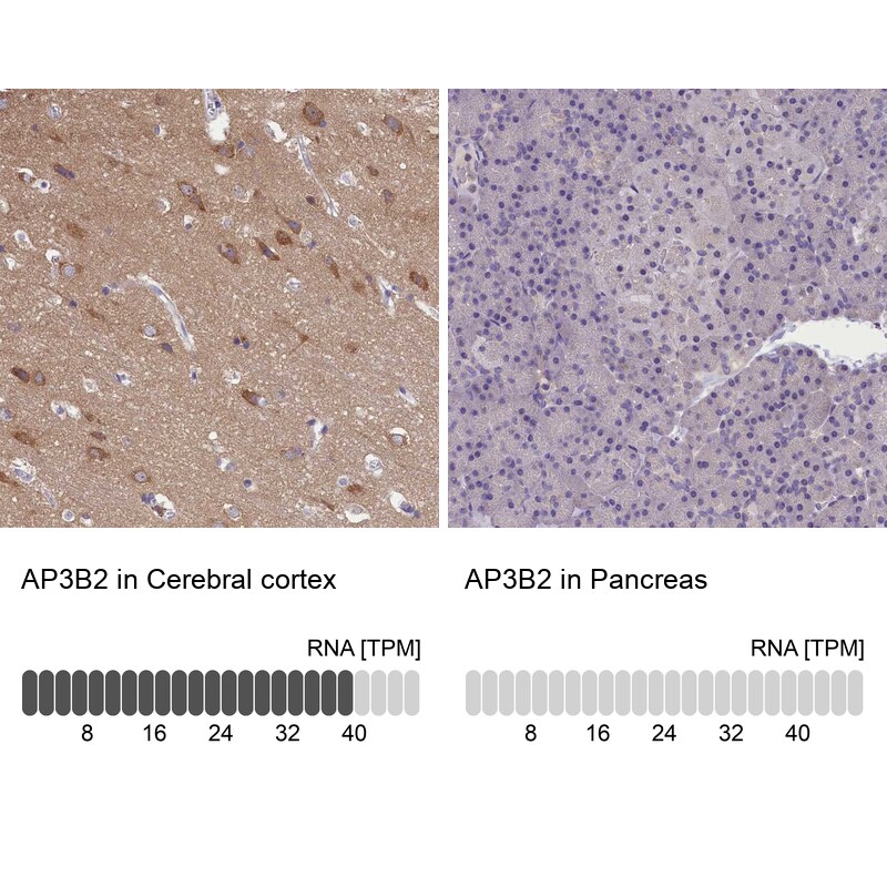 AP3B2 Antibody - BSA Free Immunohistochemistry-Paraffin: AP3B2 Antibody [NBP1-81012]