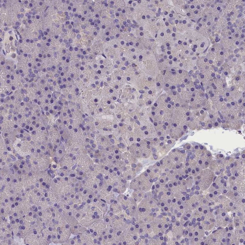 AP3B2 Antibody - BSA Free Immunohistochemistry-Paraffin: AP3B2 Antibody [NBP1-81012]
