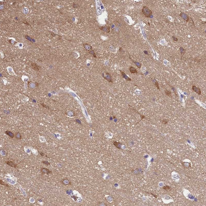 AP3B2 Antibody - BSA Free Immunohistochemistry-Paraffin: AP3B2 Antibody [NBP1-81012]