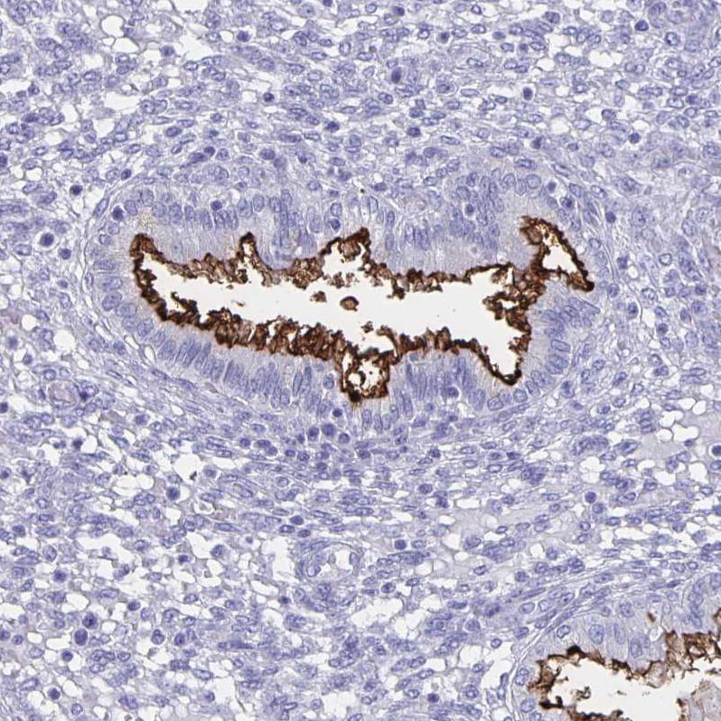 SLC34A2 Antibody - BSA Free Immunohistochemistry-Paraffin: SLC34A2 Antibody [NBP1-81013]