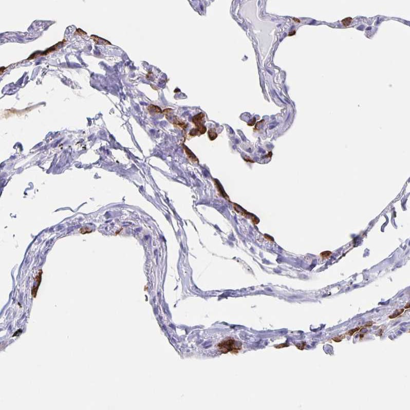 SLC34A2 Antibody - BSA Free Immunohistochemistry-Paraffin: SLC34A2 Antibody [NBP1-81013]