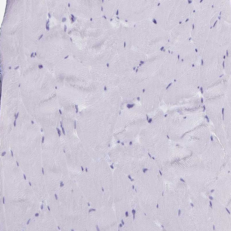 SLC34A2 Antibody - BSA Free Immunohistochemistry-Paraffin: SLC34A2 Antibody [NBP1-81013]