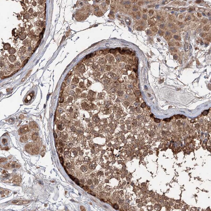 DEXI Antibody - BSA Free Immunohistochemistry-Paraffin: DEXI Antibody [NBP1-81015]