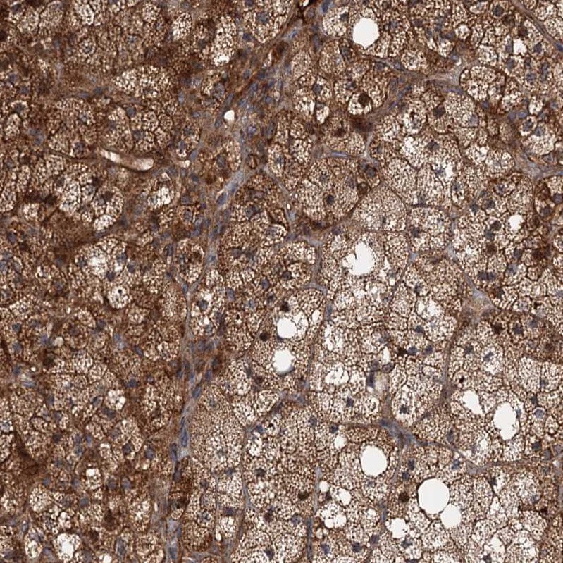 DEXI Antibody - BSA Free Immunohistochemistry-Paraffin: DEXI Antibody [NBP1-81015]