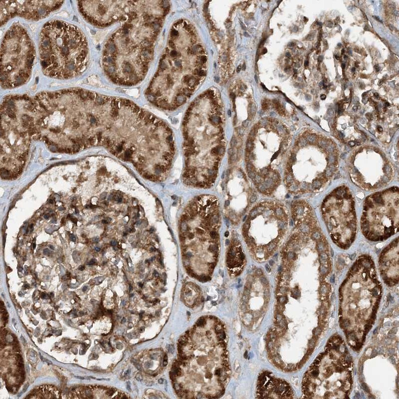 HEMK1 Antibody - BSA Free Immunohistochemistry: HEMK1 Antibody - BSA Free [NBP1-81020]