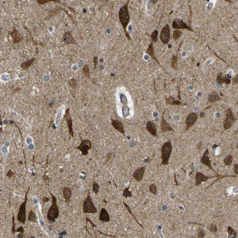 KCTD10 Antibody - BSA Free Immunohistochemistry-Paraffin: KCTD10 Antibody [NBP1-81023]