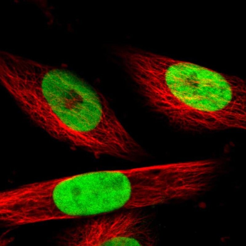MeCP2 Antibody - BSA Free Immunocytochemistry/ Immunofluorescence: MeCP2 Antibody [NBP1-81027]