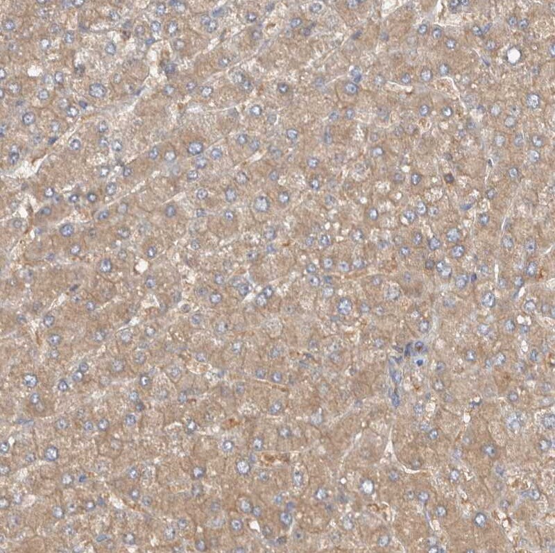 MPRIP Antibody - BSA Free Immunohistochemistry-Paraffin: MPRIP Antibody [NBP1-81035]