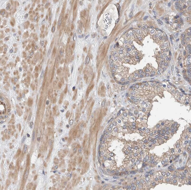 MPRIP Antibody - BSA Free Immunohistochemistry-Paraffin: MPRIP Antibody [NBP1-81035]