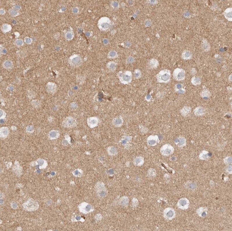 MPRIP Antibody - BSA Free Immunohistochemistry-Paraffin: MPRIP Antibody [NBP1-81035]