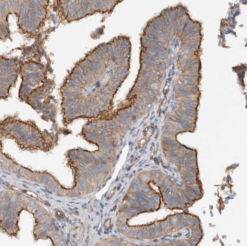MPRIP Antibody - BSA Free Immunohistochemistry-Paraffin: MPRIP Antibody [NBP1-81035]