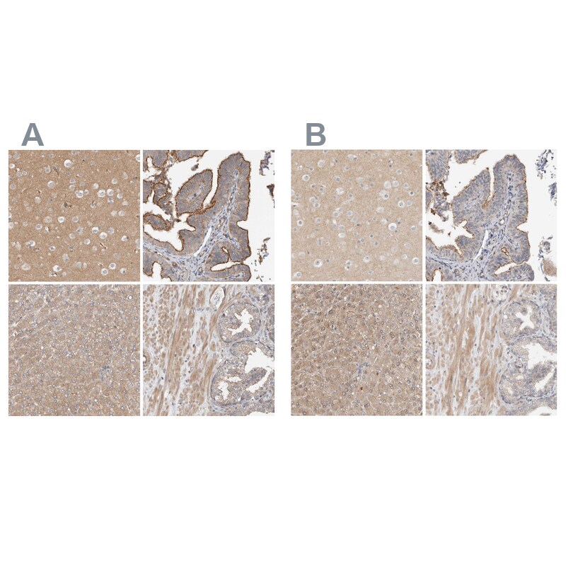 MPRIP Antibody - BSA Free Immunohistochemistry-Paraffin: MPRIP Antibody [NBP1-81035]