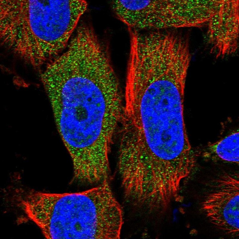 MOCS2 Antibody - BSA Free Immunocytochemistry/ Immunofluorescence: MOCS2 Antibody [NBP1-81045]