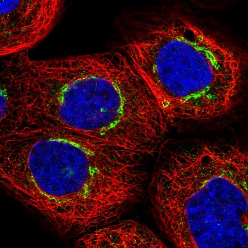 ZMYND19 Antibody - BSA Free Immunocytochemistry/ Immunofluorescence: ZMYND19 Antibody [NBP1-81047]