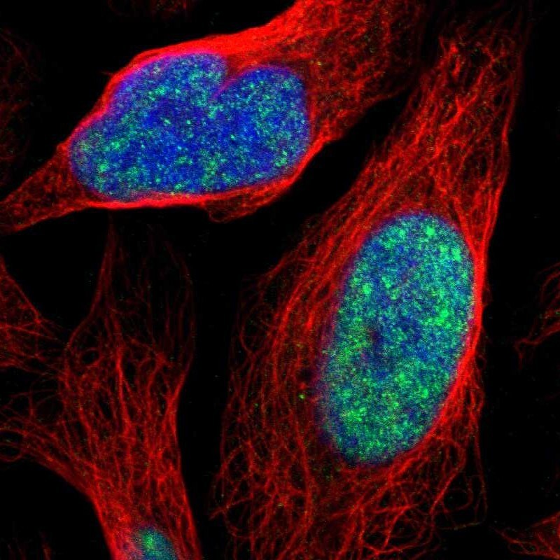 ZNF250 Antibody - BSA Free Immunocytochemistry/ Immunofluorescence: ZNF250 Antibody [NBP1-81052]